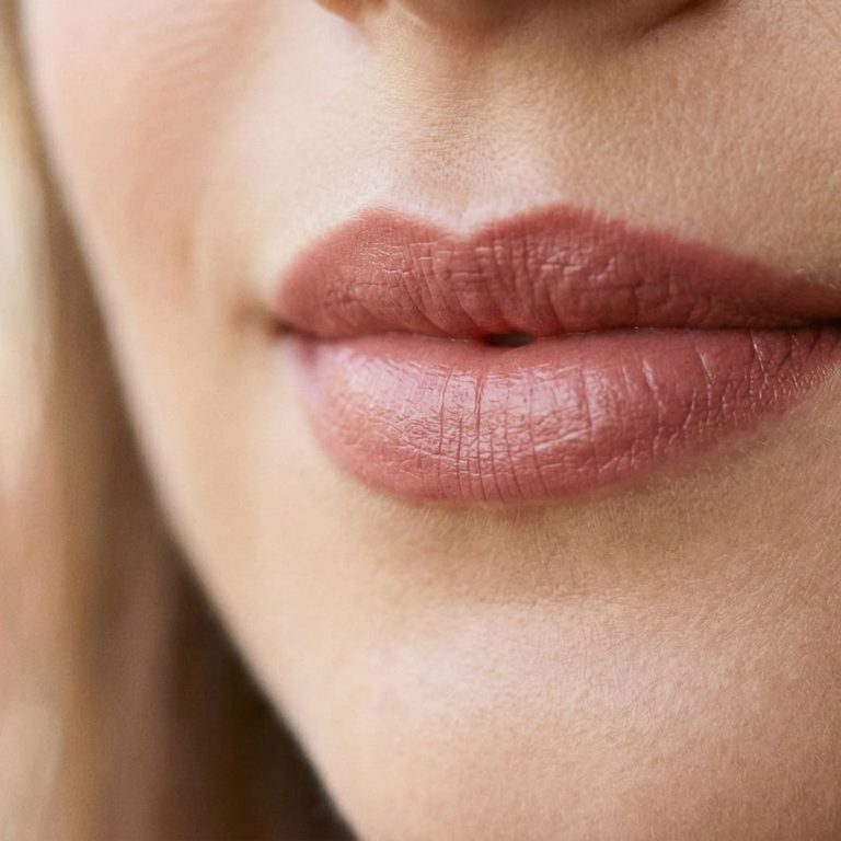 Aumento de Volumen de Labios