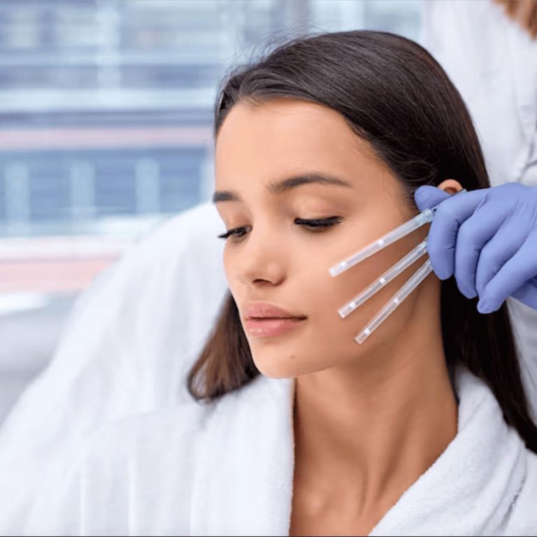 relleno facial acido hh